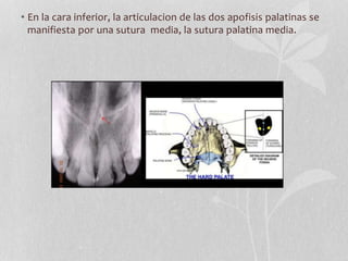 • En la cara inferior, la articulacion de las dos apofisis palatinas se
manifiesta por una sutura media, la sutura palatina media.
 