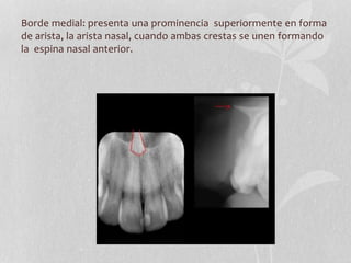 Borde medial: presenta una prominencia superiormente en forma
de arista, la arista nasal, cuando ambas crestas se unen formando
la espina nasal anterior.
 