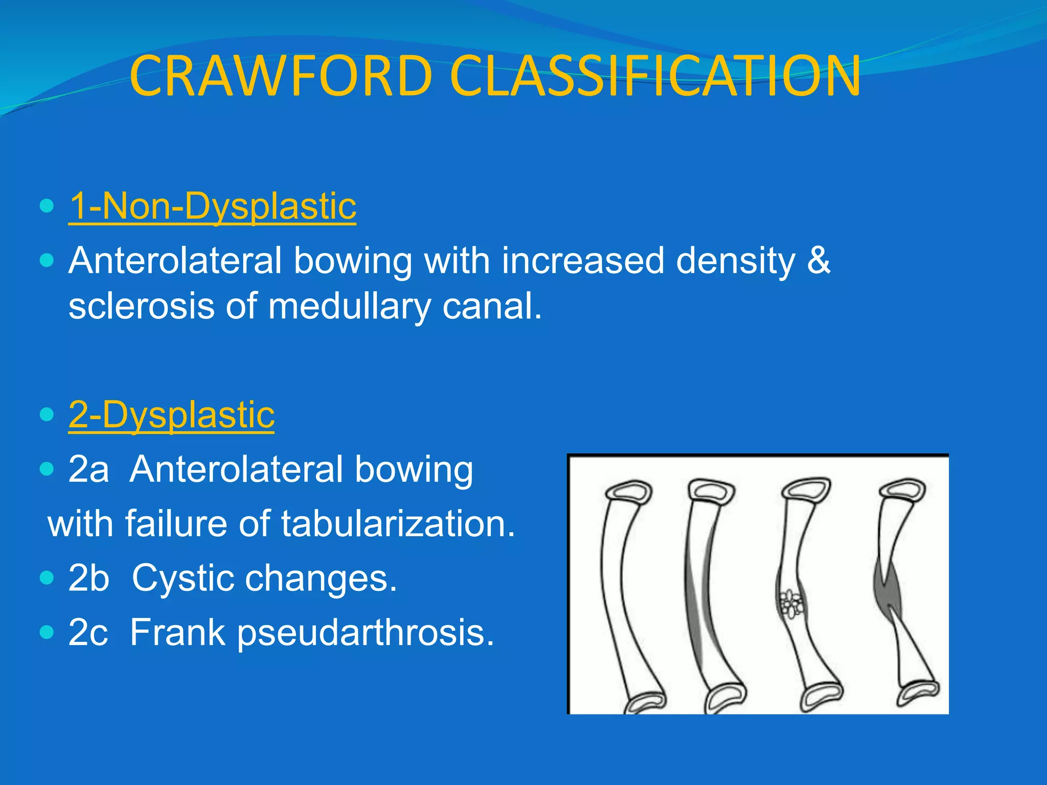 CRAWFORD CLASSIFICATION
 1-Non-Dysplastic
 Anterolateral bowing with increased density &
sclerosis of medullary canal.
 2-Dysplastic
 2a Anterolateral bowing
with failure of tabularization.
 2b Cystic changes.
 2c Frank pseudarthrosis.
 
