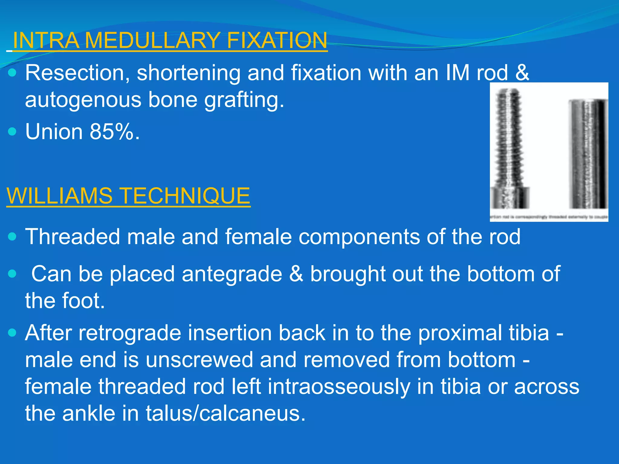 INTRA MEDULLARY FIXATION
 Resection, shortening and fixation with an IM rod &
autogenous bone grafting.
 Union 85%.
WILLIAMS TECHNIQUE
 Threaded male and female components of the rod
 Can be placed antegrade & brought out the bottom of
the foot.
 After retrograde insertion back in to the proximal tibia -
male end is unscrewed and removed from bottom -
female threaded rod left intraosseously in tibia or across
the ankle in talus/calcaneus.
 