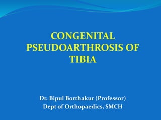 CONGENITAL
PSEUDOARTHROSIS OF
TIBIA
Dr. Bipul Borthakur (Professor)
Dept of Orthopaedics, SMCH
 