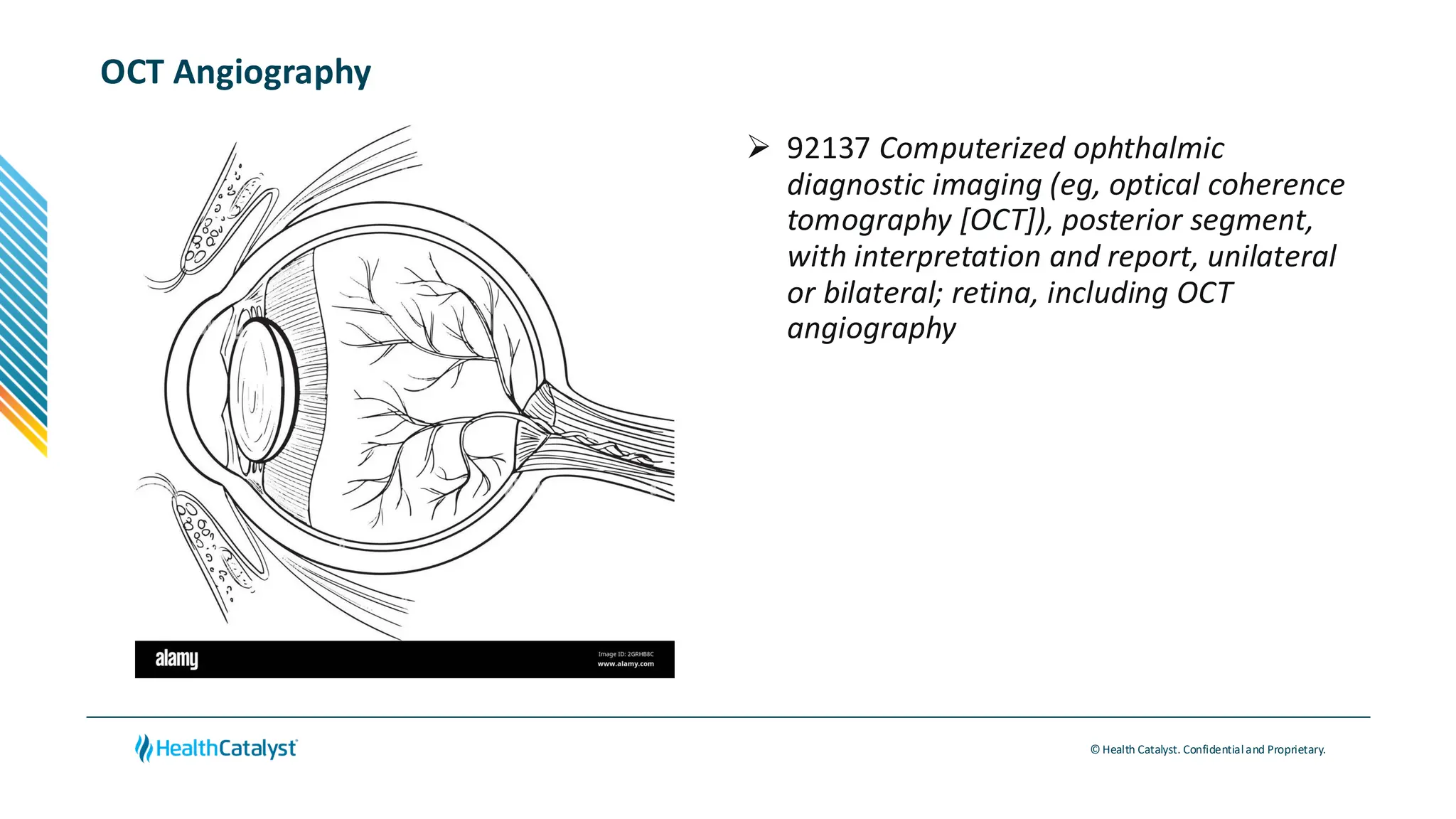 © Health Catalyst. Confidentialand Proprietary.
OCT Angiography
➢ 92137 Computerized ophthalmic
diagnostic imaging (eg, optical coherence
tomography [OCT]), posterior segment,
with interpretation and report, unilateral
or bilateral; retina, including OCT
angiography
 