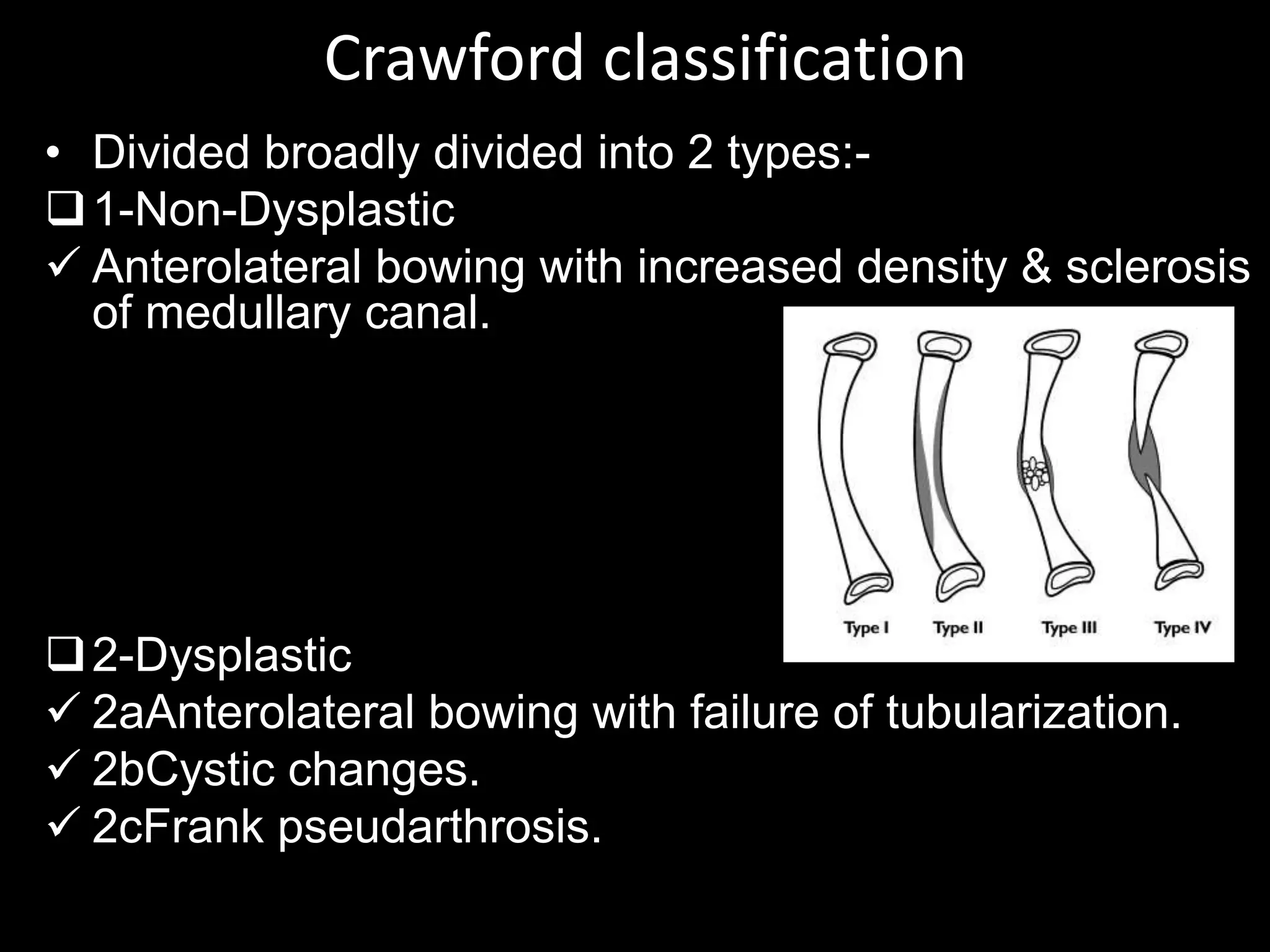Crawford classification
• Divided broadly divided into 2 types:-
1-Non-Dysplastic
 Anterolateral bowing with increased density & sclerosis
of medullary canal.
2-Dysplastic
 2aAnterolateral bowing with failure of tubularization.
 2bCystic changes.
 2cFrank pseudarthrosis.
 