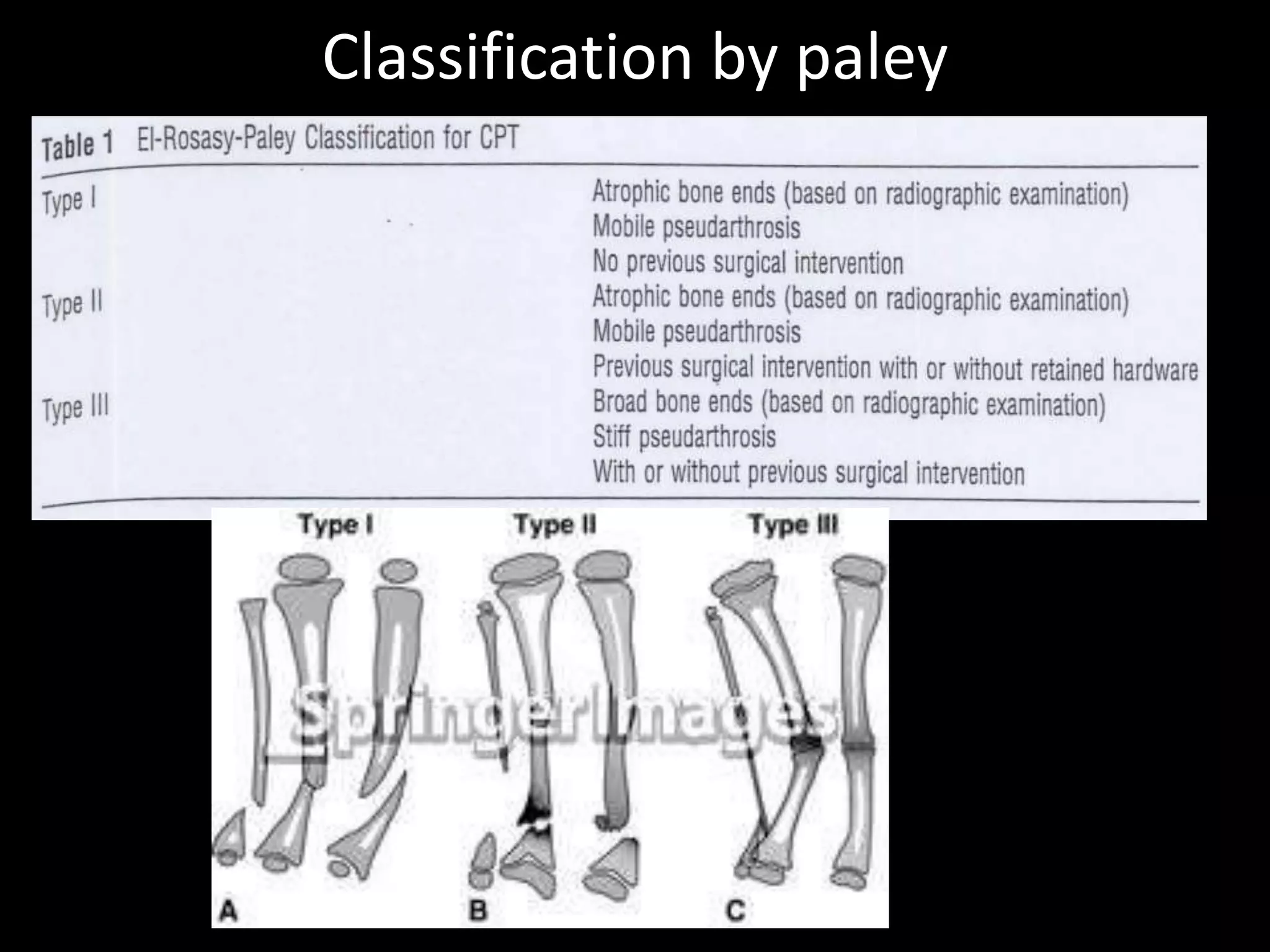 Classification by paley
 