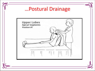 …Postural drainage
Lung segment Position Recommended
Posterior section
of the upper lobes.
Position supine with a
pillow u...