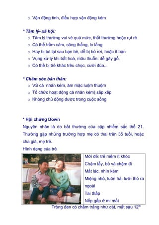 o Vận động tinh, điều hợp vận động kém
* Tâm lý- xã hội:
o Tâm lý thường vui vẻ quá mức, thất thường hoặc rụt rè
o Có thể trầm cảm, căng thẳng, lo lắng
o Hay bị tụt lại sau bạn bè, dễ bị bỏ rơi, hoặc ít bạn
o Vụng xử lý khi bất hoà, mâu thuẫn: dễ gây gổ.
o Có thể bị trẻ khác trêu chọc, cười đùa...
* Chăm sóc bản thân:
o VS cá nhân kém, ăm mặc luộm thuộm
o Tổ chức hoạt động cá nhân kém( sắp xếp
o Không chủ động được trong cuộc sống
* Hội chứng Down
Nguyên nhân là do bất thường của cặp nhiễm sắc thể 21.
Thường gặp những trường hợp mẹ có thai trên 35 tuổi, hoặc
cha già, mẹ trẻ.
Hình dạng của trẻ
Mới đẻ: trẻ mềm ít khóc
Chậm lẫy, bò và chậm đi
Mắt lác, nhìn kém
Miệng nhỏ, luôn há, lưỡi thò ra
ngoài
Tai thấp
Nếp gấp ở mi mắt
Tròng đen có chấm trắng như cát, mất sau 12th
 