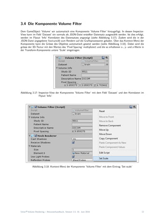 3.4 Die Komponente Volume Filter
Dem GameObject ’Volume’ wir automatisch eine Komponente ’Volume Filter’ hinzugef¨ugt. In dessen Inspector-
View kann im Feld ’Dataset’ ein vormals als JSON-Datei erstellter Datensatz ausgew¨ahlt werden. Ist dies erfolgt,
werden im Flyout ’Info’ Kenndaten des Datensatzes angezeigt (siehe Abbildung 3.17). Zudem wird die in der
JSON-Datei angegebene Texture3D zum Rendern auf die Graﬁkprozessoren geladen. ¨Uber das Kontext-Men¨u der
Komponente kann die Gr¨osse des Objektes automatisch gesetzt werden (siehe Abbildung 3.18). Dabei wird die
gr¨osse der 3D-Textur mit den Werten des ’Pixel Spacing’ multipliziert und die so erhaltenen x-, y- und z-Werte in
der Transform-Komponente untere ’Scale’ eingetragen.
Abbildung 3.17: Inspector-View der Komponente ’Volume Filter’ mit dem Feld ’Dataset’ und den Kenndaten im
Flyout ’Info’
Abbildung 3.18: Kontext-Men¨u der Komponente ’Volume Filter’ mit dem Eintrag ’Set scale’
Unity®Volume Rendering – Benutzerhandbuch, Version 1.0, 16. Juni 2016 12
 