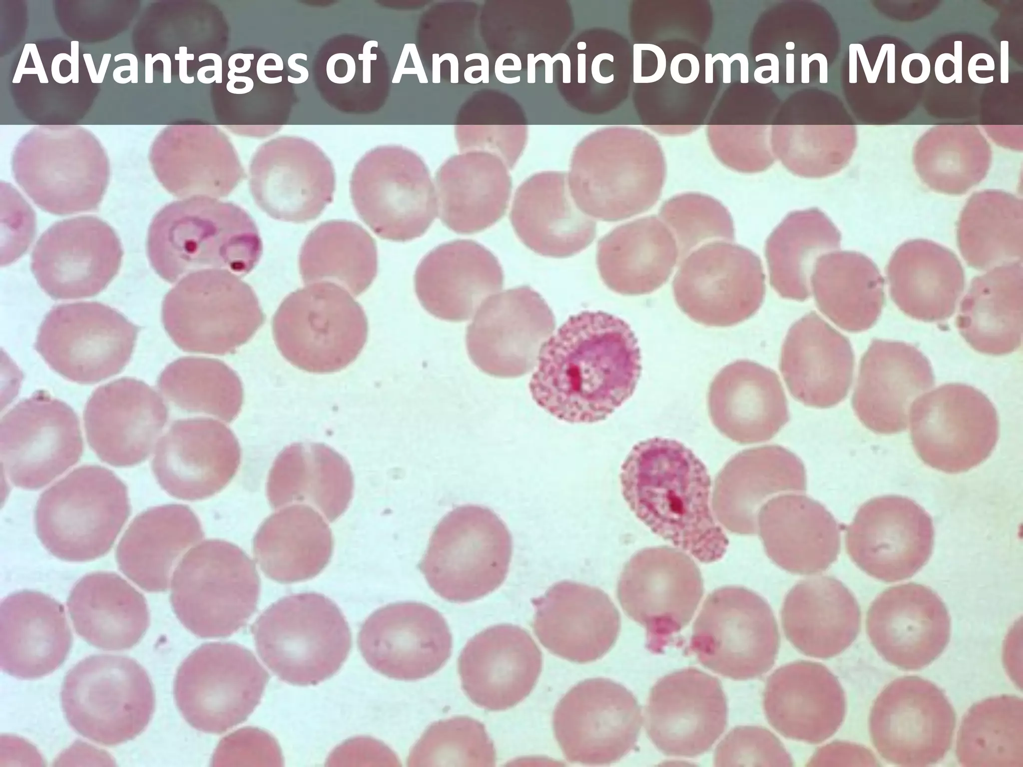 Advantages of Anaemic Domain Model
 