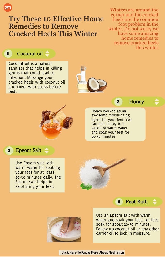 coconut oil for heel cracks