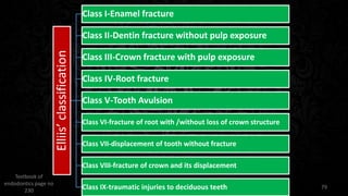 Cracked tooth syndrome in an | PPTX