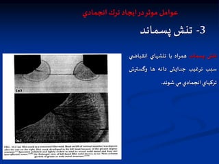 3
-
‫پسماند‬ ‫تنش‬
‫تنش‬
‫پسماند‬
‫همراه‬
‫با‬
‫تنشهاي‬
‫انقبا‬
‫ي‬ ‫ض‬
‫سبب‬
‫ترغيب‬
‫جدايش‬
‫دانه‬
‫ها‬
‫وگسترش‬
‫تركهاي‬
‫انجمادي‬
‫مي‬
‫شوند‬
.
‫انجمادي‬ ‫ترك‬ ‫ايجاد‬‫در‬‫موثر‬ ‫عوامل‬
 