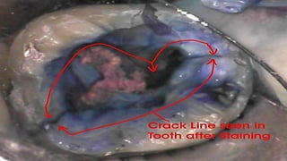 Cracks.pdf