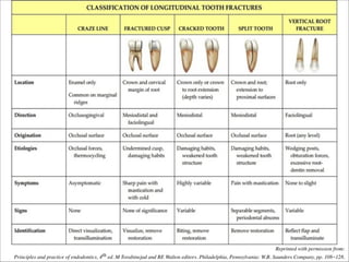 Reprinted with permission from: 
th ed. M Torabinejad and RE Walton editors. Philadelphia, Pennsylvania: W.B. Saunders Company, pp. 108-128.	

Principles and practice of endodontics, 4

 