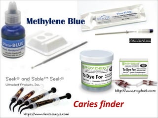 Methylene Blue

http:/
/www.roydent.com

Caries  finder
https:/
/www.dentalaegis.com

 
