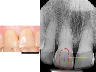 agdblogs.blogspot.com

 