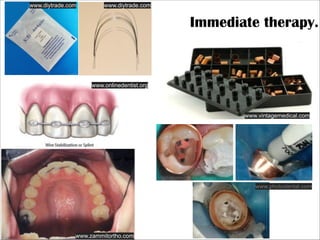 www.diytrade.com

www.diytrade.com

Immediate therapy.

www.onlinedentist.org

www.vintagemedical.com

www.photodental.com

www.zammitortho.com

 