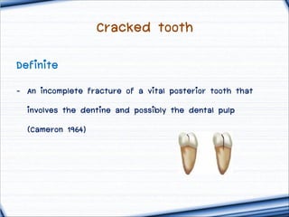 Cracked tooth
Definite
- An incomplete fracture of a vital posterior tooth that
involves the dentine and possibly the dental pulp
(Cameron 1964)

 