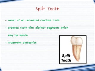 Split Tooth
- result of an untreated cracked tooth.
- cracked tooth with distinct segments which
may be mobile.
- Treatment extraction

 