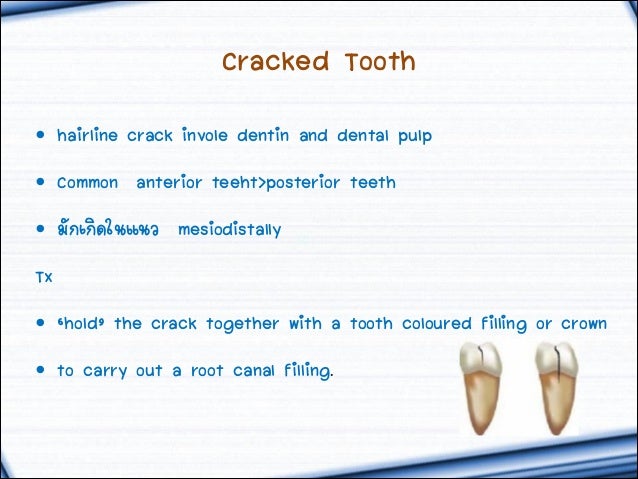 crack in tooth