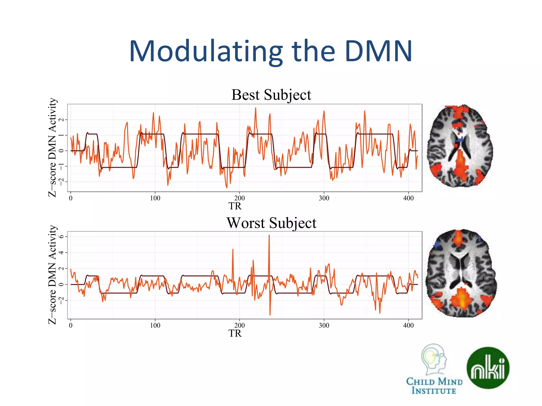 Modulating the DMN−2−1012
0 100 200 300 400
Best Subject
Worst Subject
TR
Z−scoreDMNActivity
−20246
0 100 200 300 400
TR
Z−scoreDMNActivity
 