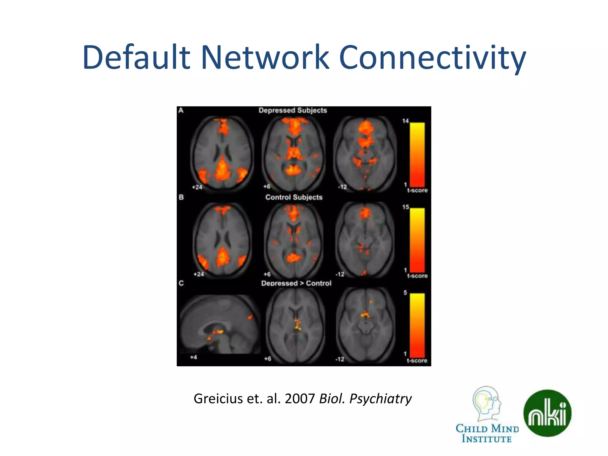Default Network Connectivity
Greicius et. al. 2007 Biol. Psychiatry
 