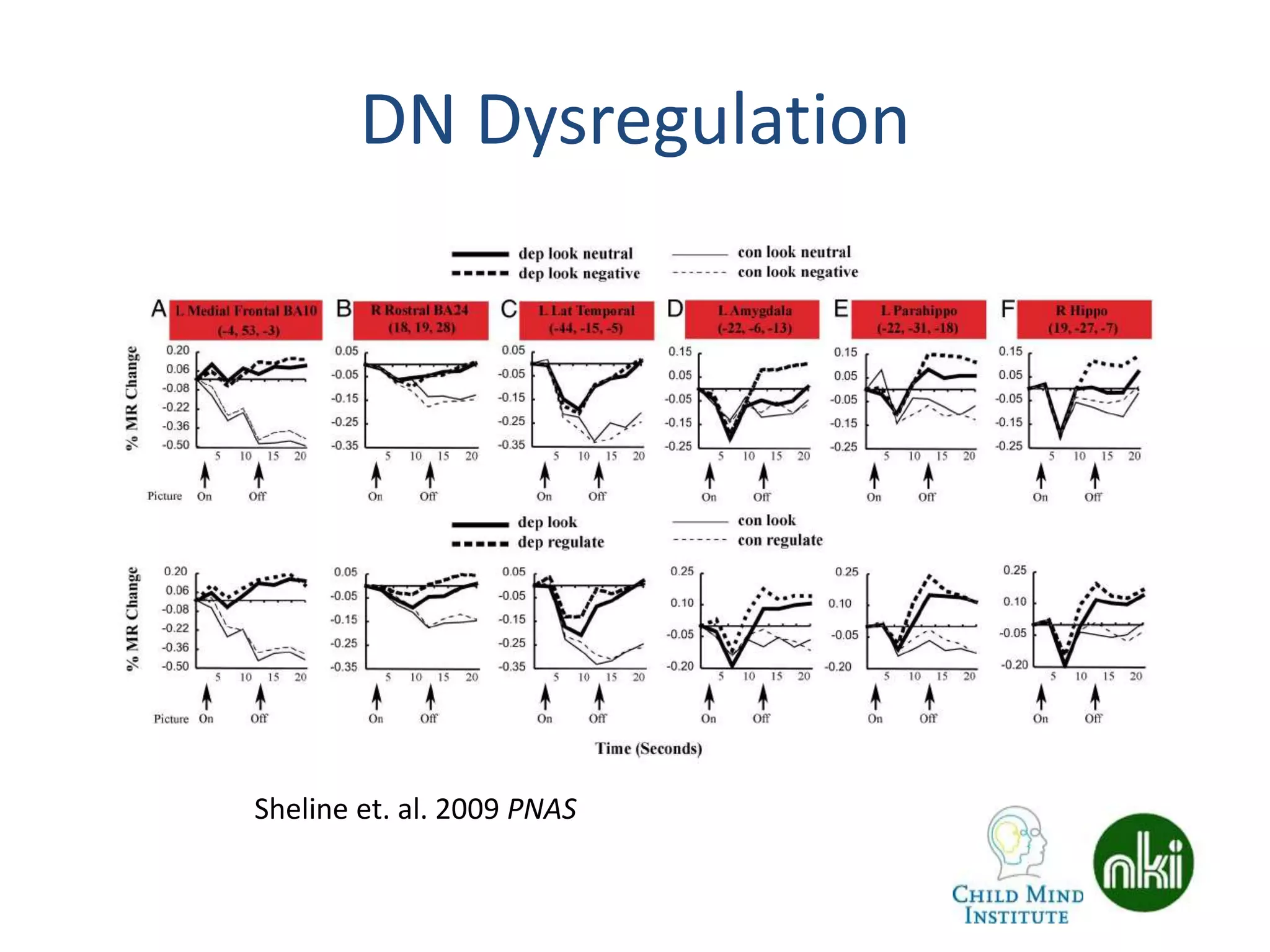 DN Dysregulation
Sheline et. al. 2009 PNAS
 