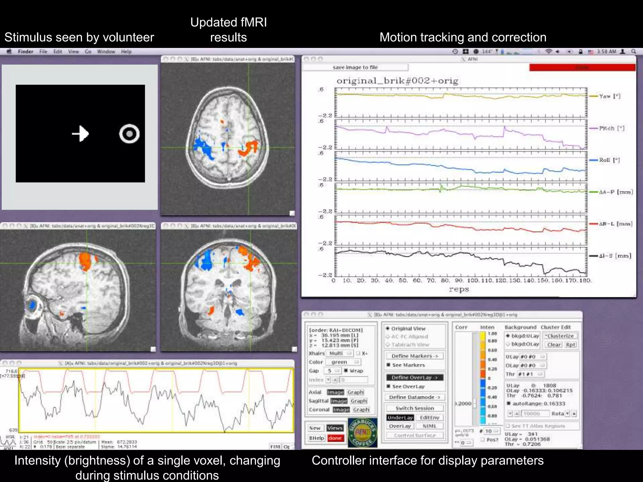 Stimulus seen by volunteer
Updated fMRI
results Motion tracking and correction
Intensity (brightness) of a single voxel, changing
during stimulus conditions
Controller interface for display parameters
 