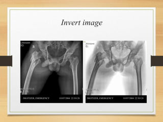 Inverted Radiographic Film CR and DR.ppt
