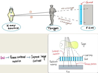 First Computed Radiography Computed Radiography and digital radiography | PPTX