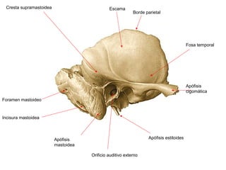 Cresta supramastoidea                        Escama
                                                           Borde parietal




                                                                                        Fosa temporal




                                                                                        Apófisis
                                                                                        cigomática
Foramen mastoideo



Incisura mastoidea



                         Apófisis                                 Apófisis estiloides
                         mastoidea

                                     Orificio auditivo externo
 