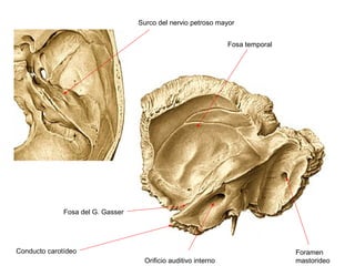 Surco del nervio petroso mayor


                                                                Fosa temporal




              Fosa del G. Gasser




Conducto carotídeo                                                              Foramen
                                    Orificio auditivo interno                   mastorideo
 
