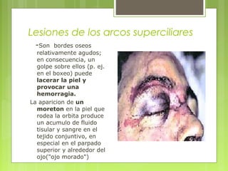 Lesiones de los arcos superciliares
-Son bordes oseos
relativamente agudos;
en consecuencia, un
golpe sobre ellos (p. ej.
en el boxeo) puede
lacerar la piel y
provocar una
hemorragia.
La aparicion de un
moreton en la piel que
rodea la orbita produce
un acumulo de fluido
tisular y sangre en el
tejido conjuntivo, en
especial en el parpado
superior y alrededor del
ojo("ojo morado")
 