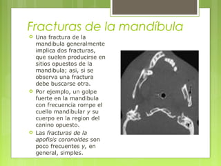  
Fracturas de la mandíbula
 Una fractura de la
mandibula generalmente
implica dos fracturas,
que suelen producirse en
sitios opuestos de la
mandibula; asi, si se
observa una fractura
debe buscarse otra.
 Por ejemplo, un golpe
fuerte en la mandibula
con frecuencia rompe el
cuello mandibular y su
cuerpo en la region del
canino opuesto.
 Las fracturas de la
apofisis coronoides son
poco frecuentes y, en
general, simples.
 