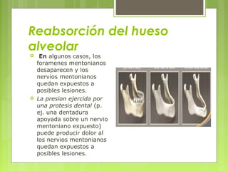 Reabsorción del hueso
alveolar
 En algunos casos, los
foramenes mentonianos
desaparecen y los
nervios mentonianos
quedan expuestos a
posibles lesiones.
 La presion ejercida por
una protesis dental (p.
ej. una dentadura
apoyada sobre un nervio
mentoniano expuesto)
puede producir dolor al
los nervios mentonianos
quedan expuestos a
posibles lesiones.
 
