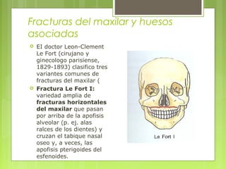 Fracturas del maxilar y huesos
asociadas
 EI doctor Leon-Clement
Le Fort (cirujano y
ginecologo parisiense,
1829-1893) clasifico tres
variantes comunes de
fracturas del maxilar (
 Fractura Le Fort I:
variedad amplia de
fracturas horizontales
del maxilar que pasan
por arriba de la apofisis
alveolar (p. ej. alas
ralces de los dientes) y
cruzan el tabique nasal
oseo y, a veces, las
apofisis pterigoides del
esfenoides.
 