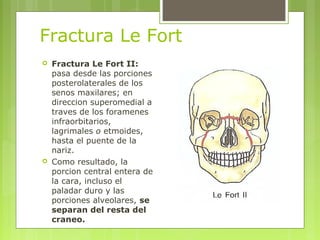 Fractura Le Fort
 Fractura Le Fort II:
pasa desde las porciones
posterolaterales de los
senos maxilares; en
direccion superomedial a
traves de los foramenes
infraorbitarios,
lagrimales o etmoides,
hasta el puente de la
nariz.
 Como resultado, la
porcion central entera de
la cara, incluso el
paladar duro y las
porciones alveolares, se
separan del resta del
craneo.
 