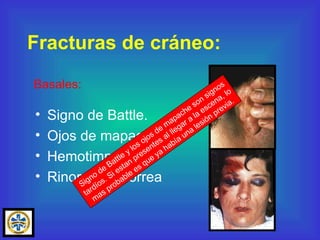 Signo de Battle. Ojos de mapache. Hemotimpano. Rinorrea / Otorrea Fracturas de cráneo: Basales: Signo de Battle y los ojos de mapache son signos tardíos. Si estan presentes al llegar a la escena, lo mas probable es que ya había una lesión previa. 