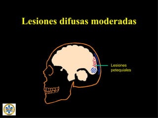 Lesiones difusas moderadas Lesiones petequiales 