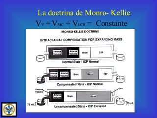 La doctrina de Monro- Kellie: V V   + V MC  + V LCR  =  Constante 
