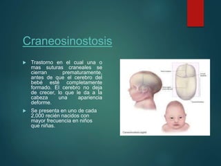 Craneosinostosis
 Trastorno en el cual una o
mas suturas craneales se
cierran prematuramente,
antes de que el cerebro del
bebé esté completamente
formado. El cerebro no deja
de crecer, lo que le da a la
cabeza una apariencia
deforme.
 Se presenta en uno de cada
2,000 recién nacidos con
mayor frecuencia en niños
que niñas.
 