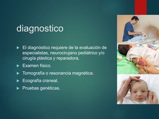 diagnostico
 El diagnóstico requiere de la evaluación de
especialistas, neurocirujano pediátrico y/o
cirugía plástica y reparadora.
 Examen físico.
 Tomografía o resonancia magnética.
 Ecografía craneal.
 Pruebas genéticas.
 