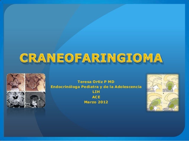 Craneofaringioma