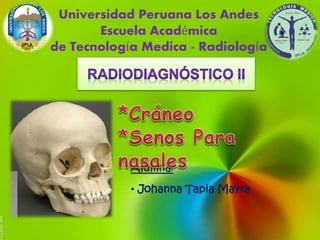 Universidad Peruana Los Andes
Escuela Académica
de Tecnología Medica - Radiología
Alumna:
• Johanna Tapia Mayta
 