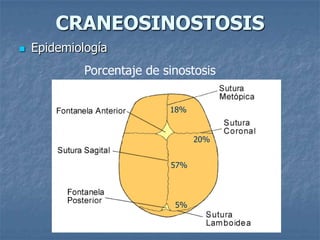 CRANEOSINOSTOSIS
   Epidemiología
             Porcentaje de sinostosis


                            18%


                                  20%


                            57%



                             5%
 