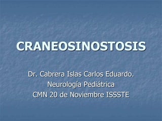 CRANEOSINOSTOSIS

 Dr. Cabrera Islas Carlos Eduardo.
       Neurología Pediátrica
  CMN 20 de Noviembre ISSSTE
 