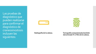 Las pruebas de
diagnóstico que
pueden realizarse
para confirmar el
diagnóstico de
craneosinostosis
incluyen las
siguientes:
Radiografía de la cabeza. Tomografía computarizada (también
denominadaTC oTAC) de la cabeza.
 