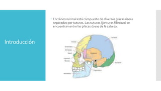 Introducción
 El cráneo normal está compuesto de diversas placas óseas
separadas por suturas. Las suturas (junturas fibrosas) se
encuentran entre las placas óseas de la cabeza.
 