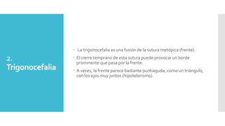 2.
Trigonocefalia
 La trigonocefalia es una fusión de la sutura metópica (frente).
 El cierre temprano de esta sutura puede provocar un borde
prominente que pasa por la frente.
 A veces, la frente parece bastante puntiaguda, como un triángulo,
con los ojos muy juntos (hipotelorismo).
 