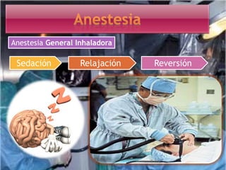 Anestesia General Inhaladora
Sedación Relajación Reversión
 