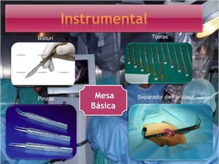Mesa
Básica
TijerasBisturí
Separador de FarabeufPinzas
 